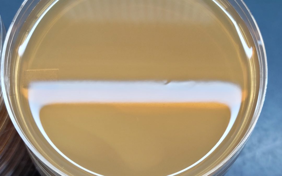 Step-By-Step Guide to pouring Agar Plates