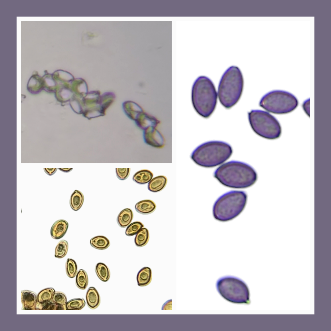 Spore Collage