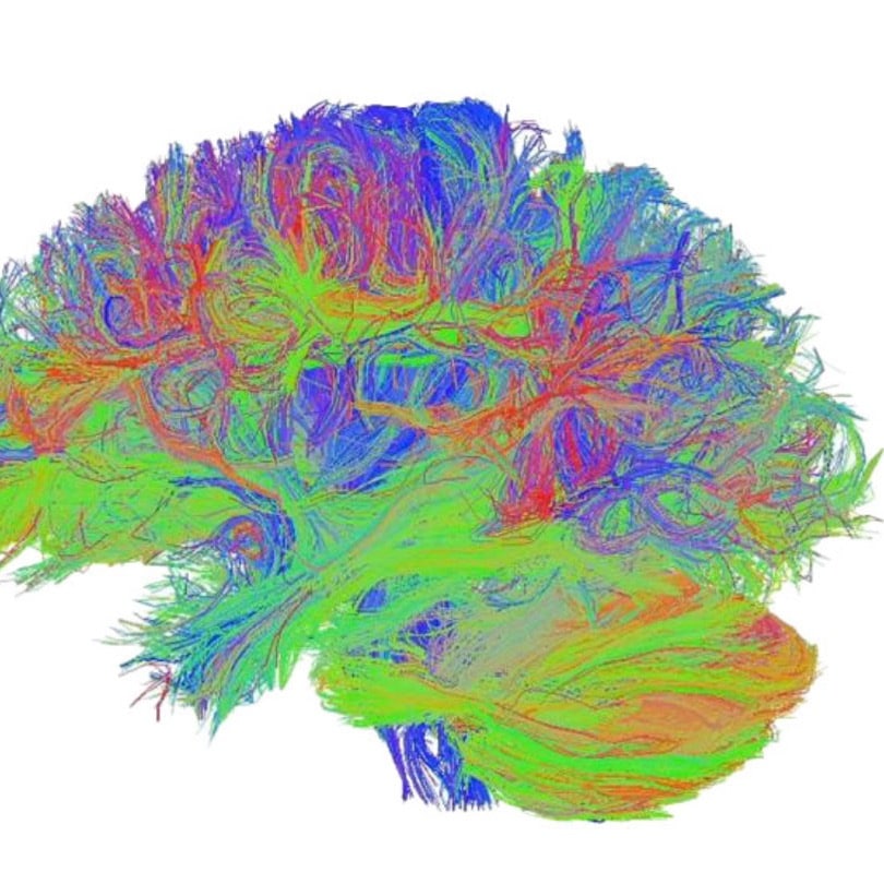 Brain scan illustrating areas of neurogenesis potentially stimulated by compounds found in Lion’s Mane mushroom (Hericium erinaceus), highlighting its role in supporting brain health and cognitive function.